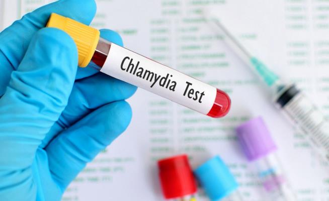 xét nghiệm bệnh chlamydia
