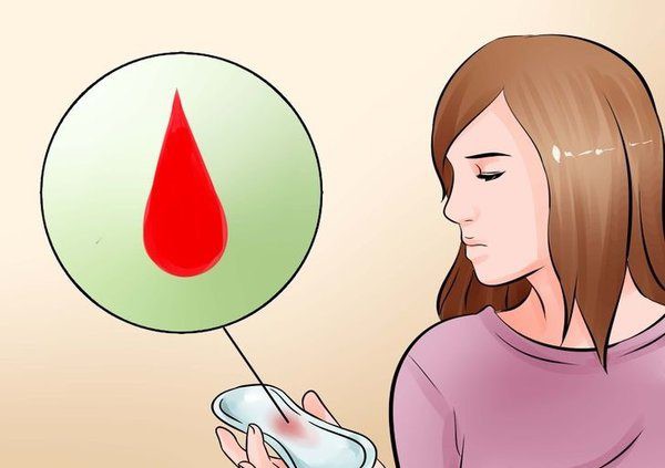 xuất huyết âm đạo có thể là biểu hiện của viêm lộ tuyến
