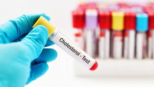 xét nghiệm Cholesterol