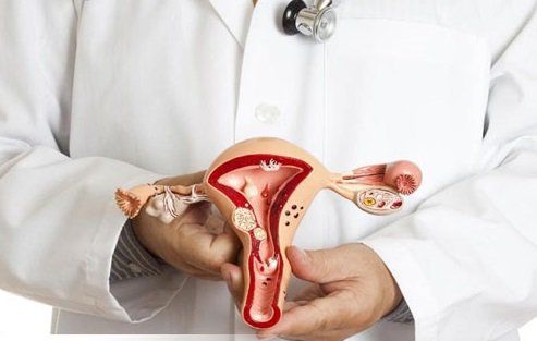 Polyp cổ tử cung là gì? Nguyên nhân, biểu hiện và cách chữa trị